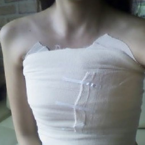 我今年十六岁,胸部已经刚刚开始发育,请问现在需要带胸罩了吗