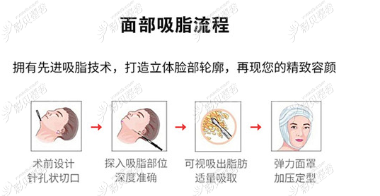 长春擅长面部吸脂的医生是麦西美嘉的姜龙白,双下巴再见!