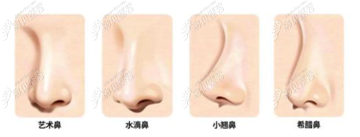 上海隆鼻口碑好的医生推荐做鼻子风格自然性价比还高