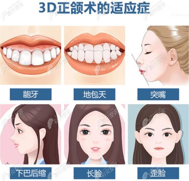 在广州做正颌手术哪家医院做得好呀顺便说下正颌手术收费