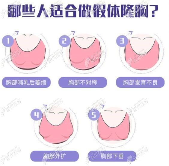 曼托隆胸假体毛面和光面的区别,圆形和水滴形假体选择哪个好等问题