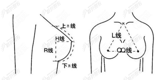 假体隆胸手术后左右胸部出现高低不一样的症状怎么办