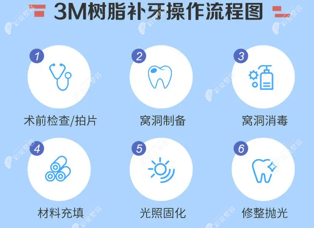 3m树脂补牙几种型号区别大全看补牙3m树脂z350与p60哪个好