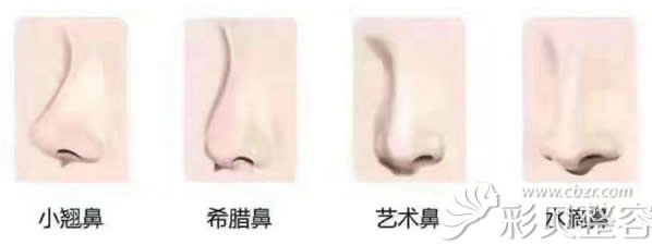 韩国流行鼻型种类