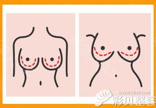 乳房是什么样子的图片