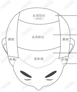 头部分区