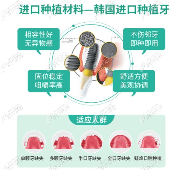 韩国进口种植牙怎么样