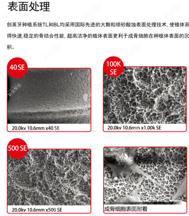 TLE种植牙系统优点