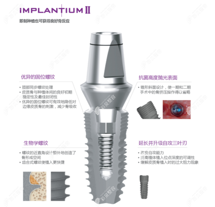 登腾种植牙implantium Ⅱ系列型号图谱