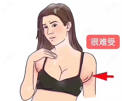 女性副乳疼图片